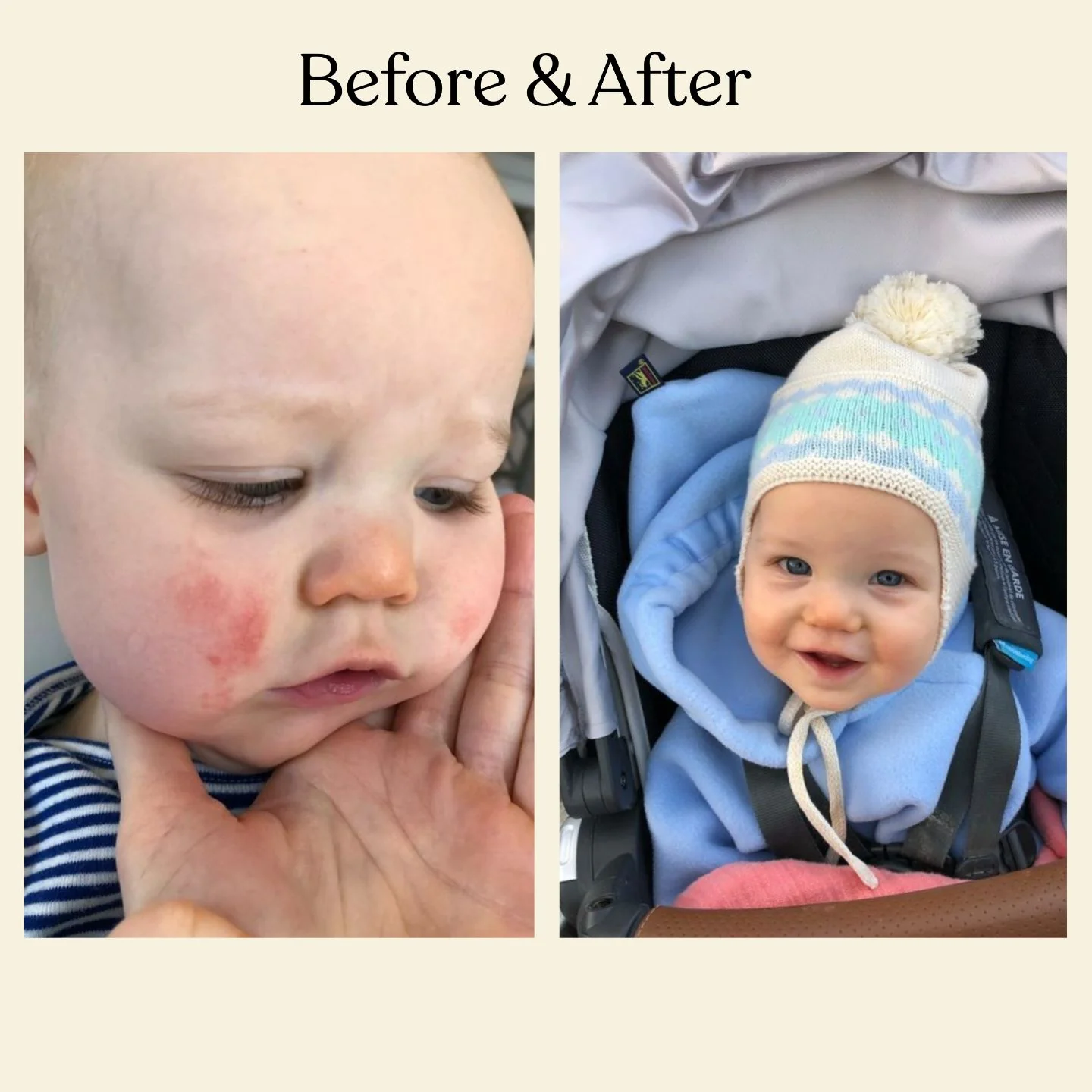 Moisturizing Baby Face Cream - Image 3