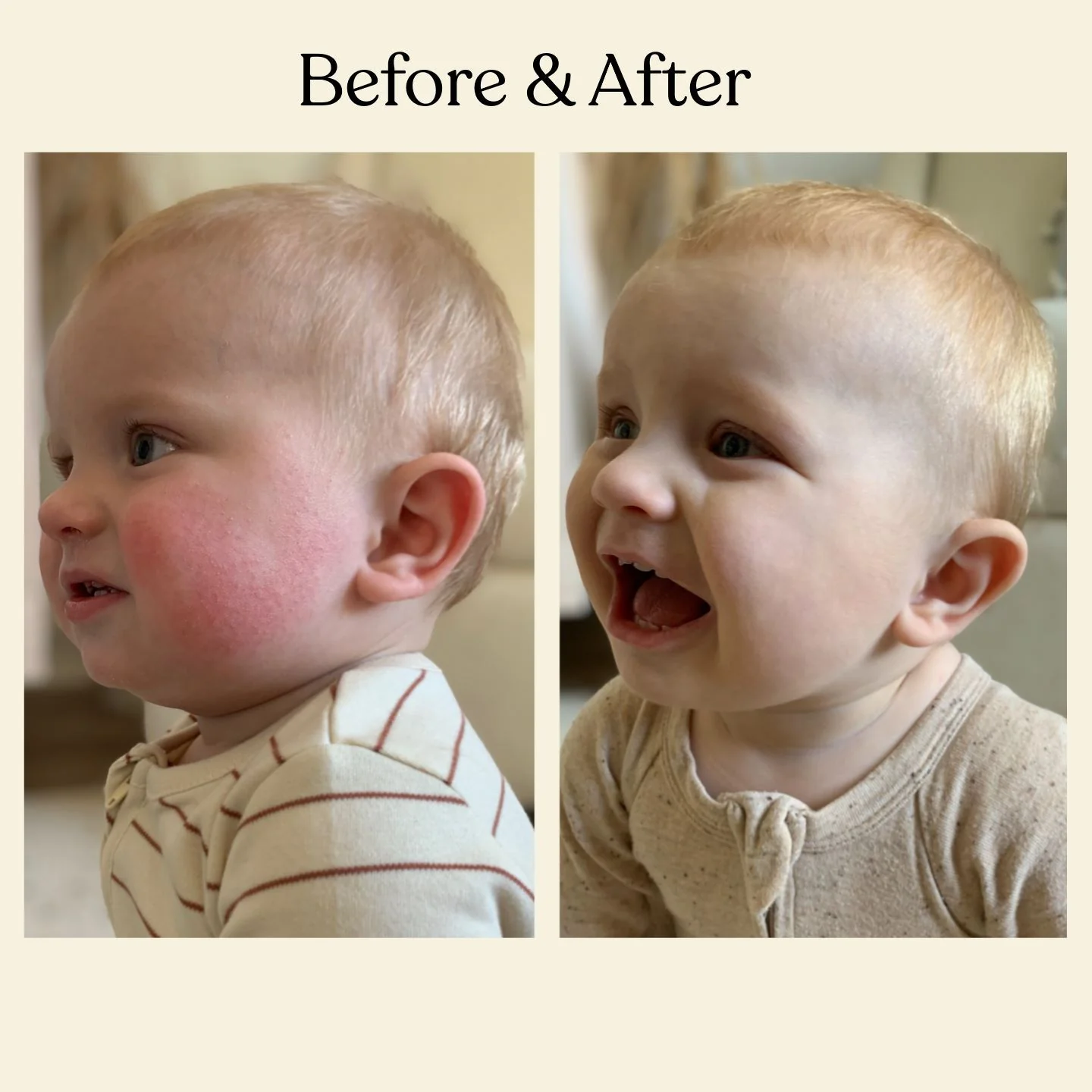 Moisturizing Baby Face Cream - Image 4
